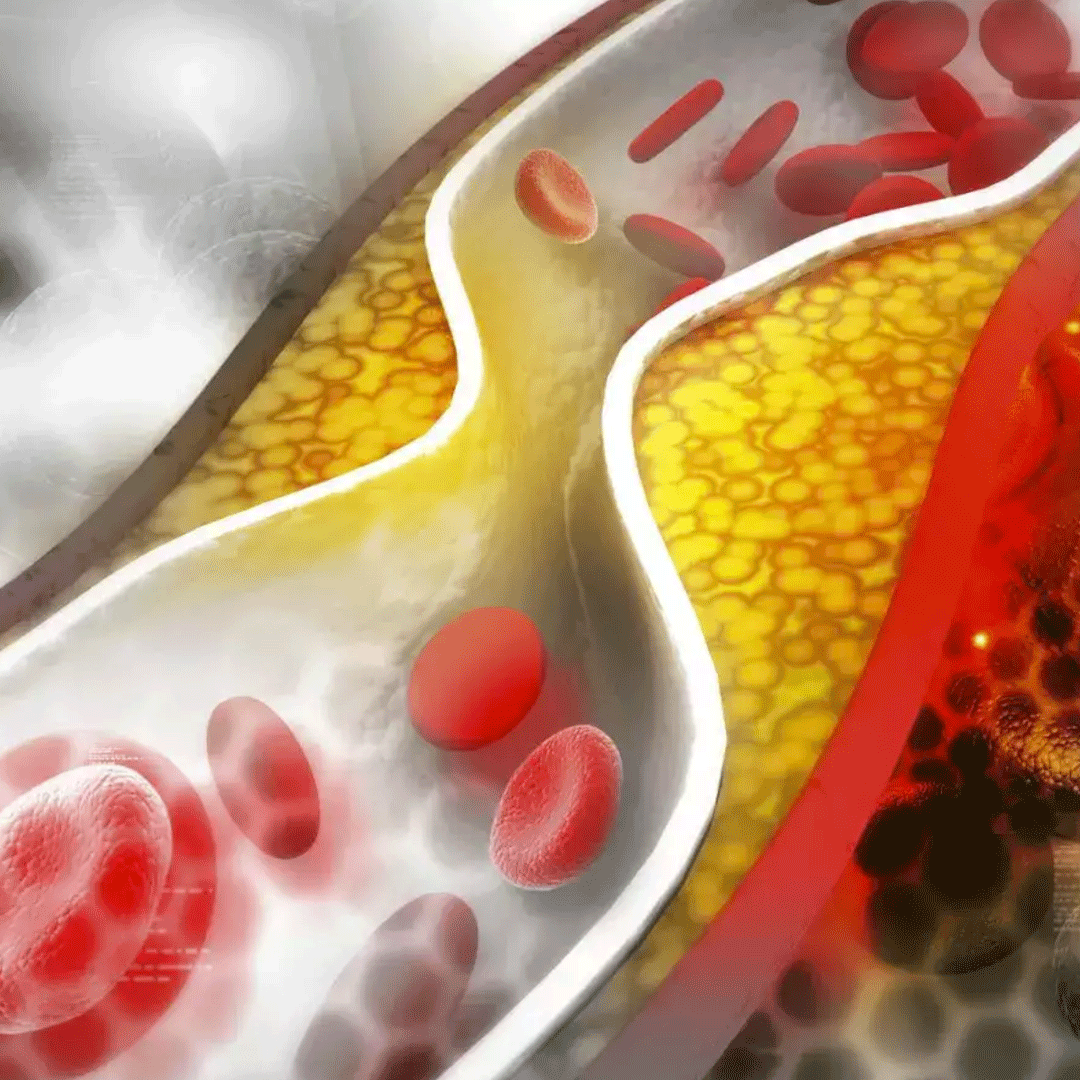 Χοληστερίνη-Λιπίδια